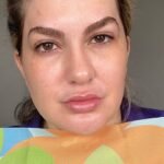 CORES QUE ACENTUAM O MELASMA POR ALICE SALAZAR