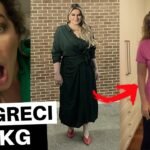 COMO ESTÁ A MINHA CIRURGIA BARIÁTRICA HOJE EM DIA POR ALICE SALAZAR (CONTEI TUDO)